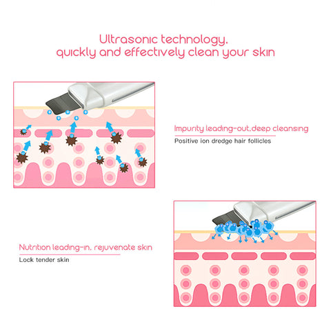 Image of Ultrasonic Deep Pore Cleaning Machine