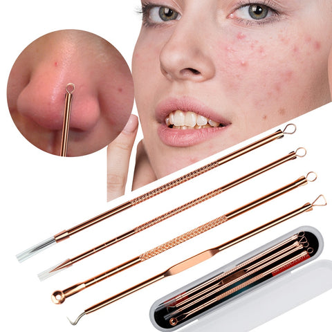 Image of 4pcs/set Blackhead Pimple Belmish Remover Tool